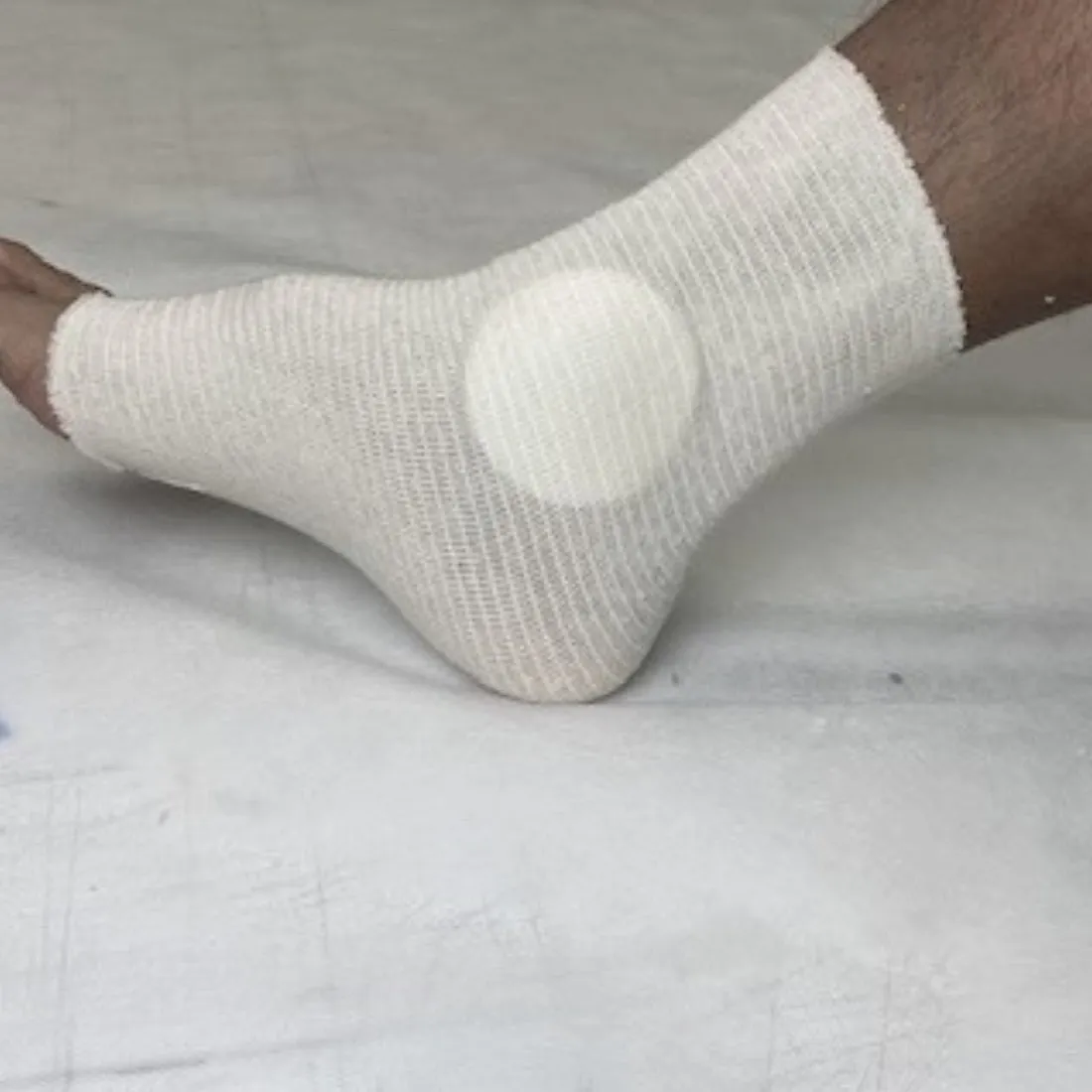 ULTRAGEL® BODY CARE-GEL MALLEOLAR ANKLE PADS